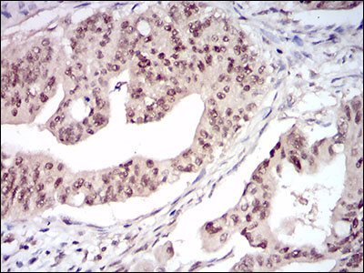IHC - DNMT1 Antibody AO1843a